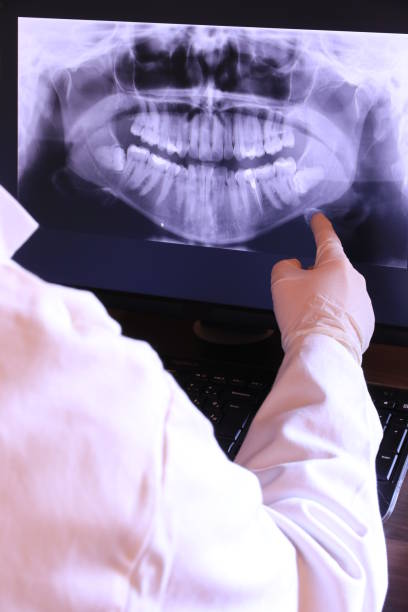 Best Emergency Treatment for Dental Infections or Abscesses in Loma Ri, CA